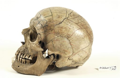 Schedel in Israël gevonden die 3.500 jaar oude hersenoperatie aantoont