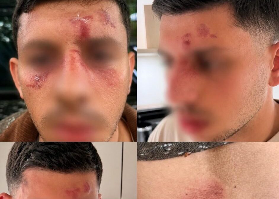 Aangevallen jongen (beeld: Instagram)